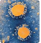 SARS virus